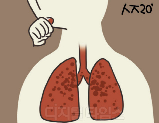 [ ǰ ϱ] Ҹ   COPD